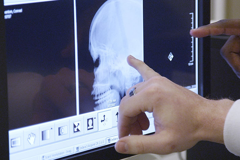 Students pointing to an x-ray of a skull 